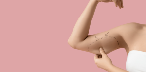 How Much Does Liposuction Cost in Arlington Virginia